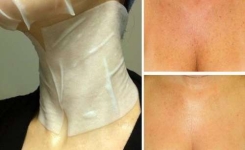 Un masque PUISSANT pour protéger votre cou et le décolleté…Efficace et 100 % naturel !