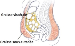  Un Remède Naturel pour Réduire la Graisse Viscérale