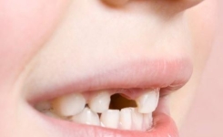 Pourquoi Vous Devriez Conserver les Dents de Lait de Vos Enfants : Les Dentistes Expliquent