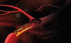 🩺 Le taux de cholestérol à ne pas dépasser (explication simple)