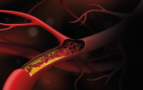 🩺 Le taux de cholestérol à ne pas dépasser (explication simple)