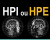 Comment faire la différence entre HPI ou HPE ?